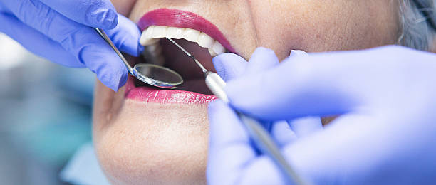 Best Emergency Wisdom Tooth Extraction in Harrington Park, NJ